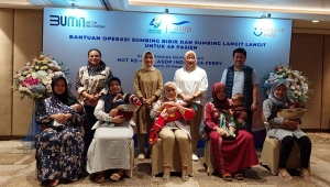 HUT ke-49, ASDP Gelar Operasi Sumbing Bibir Gratis