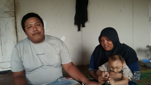 Balita Penderita Tumor di Lampung Timur