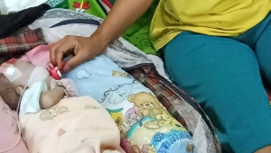 Bayi Penderita Jantung dan Paru-paru di Lampung Timur